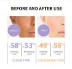LANBENA Niacinyl Whitening Sunscreen Waterproof Lightweight SPF50+ PA++ High Sunfast Moisturizing Soothing Sensitive Sunscreen